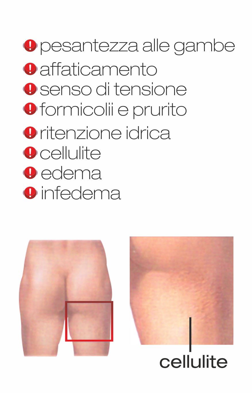 cattiva circolazione gambe e cellulite